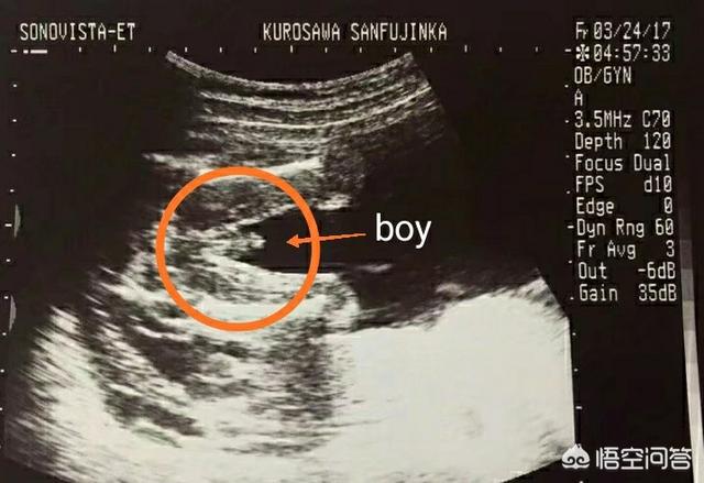 头条问答 胎儿性别是什么时候形成的 有何科学依据 50个回答