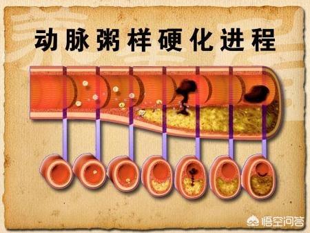麦德氏inplus和incat:养狗为什么能降低心脏病的发病率？