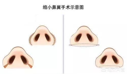 李多海电视剧:李多海在韩国是靠整容出名的吗？