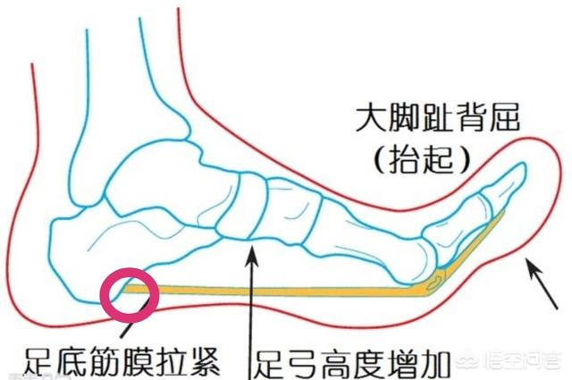 寿根骨图解图片