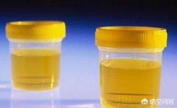 晚上尿液很黄:长期小便偏黄，这样正常吗？应该怎么缓解？