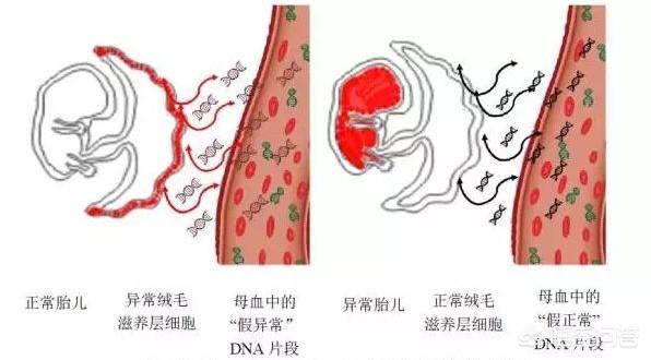 猫叫综合症:为什么会出现染色体异常的胎儿呢？