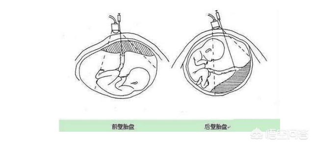 苗苗身高:郑恺苗苗跳过官宣直接领证，是因为女方怀孕么？