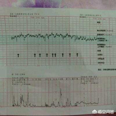 男孩真的比女孩上脉早吗，有西医说仅凭诊脉，别说怀孕，患者男女都不一定能确定这话对吗