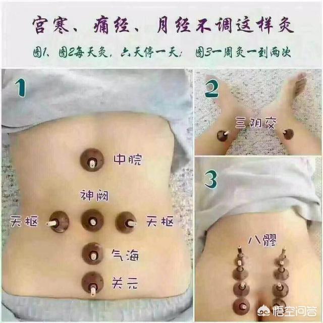 头条问答 - 月经不调,哪里艾灸好呢?(12个回答)