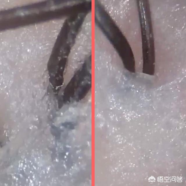 头发容易出油,用哪一款洗发露好？