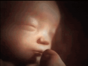 怀孕6个月，孕妇肚子突然一半硬一半软，是胎儿缺氧了吗？该怎么办？插图42