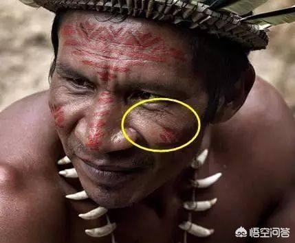 人脸上的“印第安纹”是一条什么纹？应该如何改善？