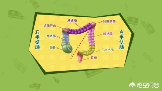 癌症晚期肠梗塞不治疗会怎样:癌症晚期不治疗会不会比化疗过程中带来的痛苦多？