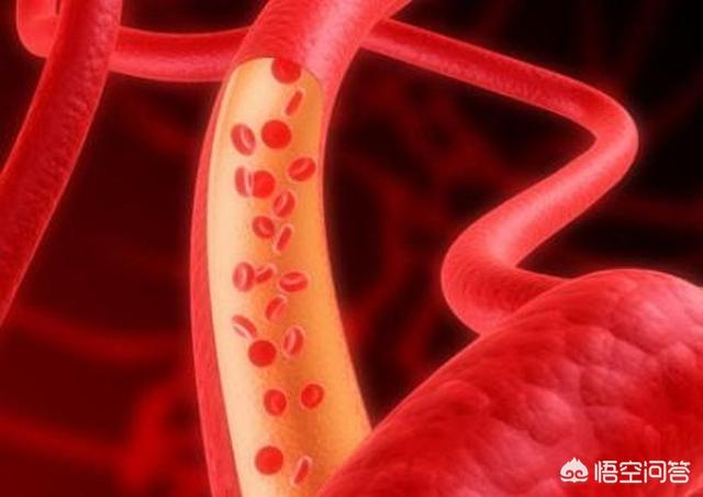 每天喝一杯白酒，对健康有害吗？插图17