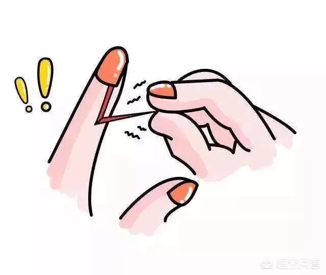 孕妇脚裂怎么办:脚气脚裂需要补充维生素吗？该怎么办？