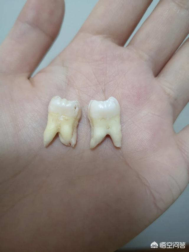迄今为止,你感到生理上最痛的一次经历是什么？