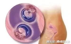 双头女婴:生了宝宝12天了，还是没多少母乳，怎么办