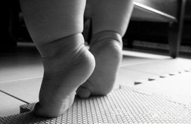 头条问答 - 如何判定宝宝尖足是生理性的还是病理性的?(10个回答)