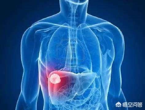 肝五项检查是什么,肝功能十二项检查是什么？