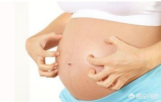 孕婦肚臍眼裡的黑色硬物可以摳出來嗎？