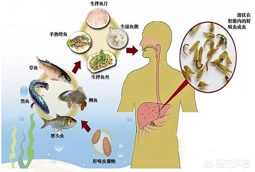 肝吸虫病症状详情:生鱼片里的肝吸虫，到底有什么危害？