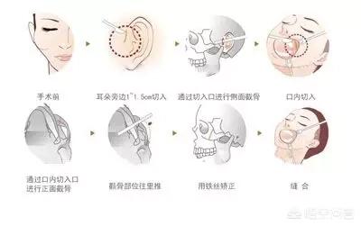 李多海电视剧:李多海在韩国是靠整容出名的吗？