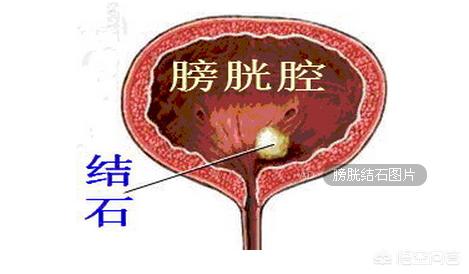 膀胱结石症状预防:狗狗膀胱结石还要化验石头吗？