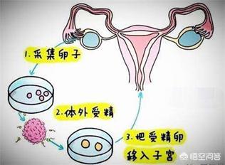 试管婴儿怀胎几个月生:试管宝宝和自然怀孕的有区别吗？