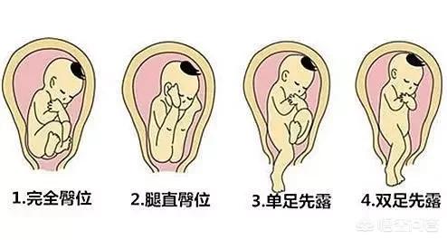 胎位b超多少钱:平罗县医院做个B超多少钱？