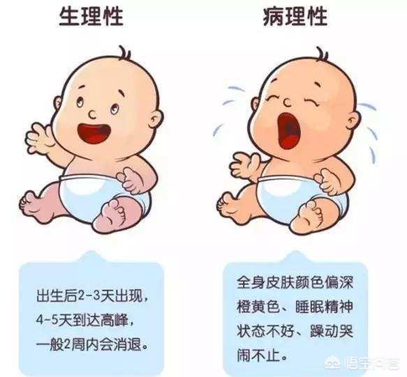 宝宝的黄疸病怎么预防:怎样在孕期预防婴儿黄疸高？