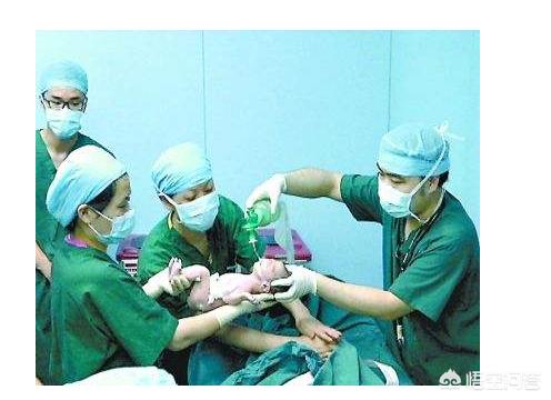 剖腹产什么情况下不打麻药