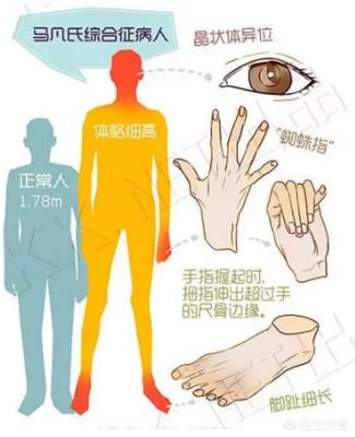 抢救运动:老戏骨程思寒因心梗早逝，做啥健身运动可以预防？
