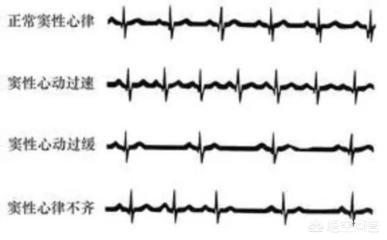 心电图右心偏大的可能性-心电图右房偏大是什么原因