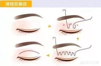 李多海电视剧:李多海在韩国是靠整容出名的吗？