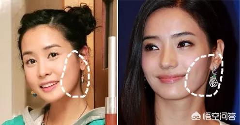 李多海电视剧:李多海在韩国是靠整容出名的吗？