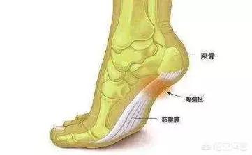 痛风脚后跟会痛吗没有碰着为什么脚后跟疼