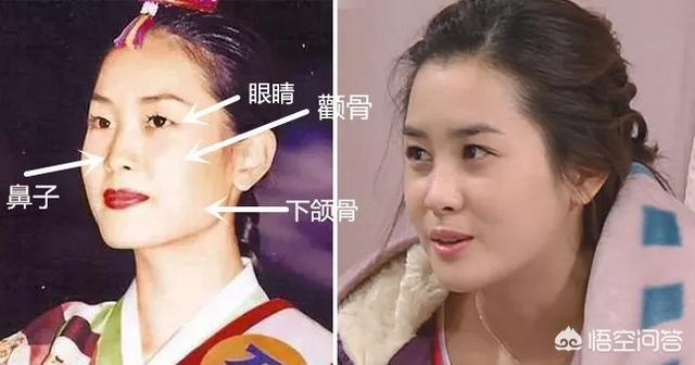 李多海电视剧:李多海在韩国是靠整容出名的吗？