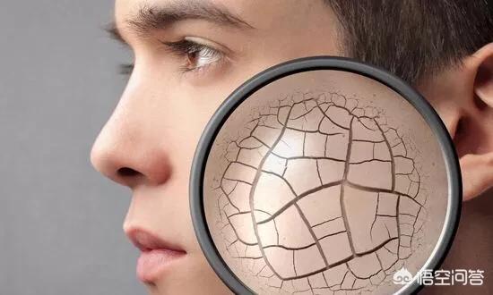 孕妇脚裂怎么办:脚气脚裂需要补充维生素吗？该怎么办？