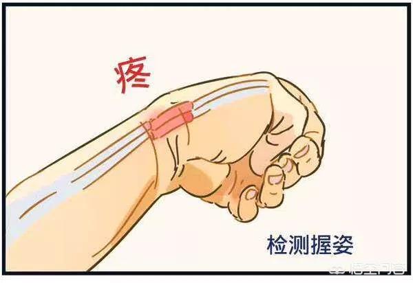 头条问答 - 手腕疼有可能是怎么回事?(7个回答)