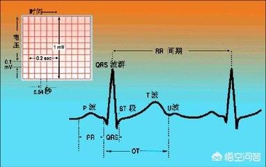 心电图右心偏大的可能性-心电图右房偏大是什么原因