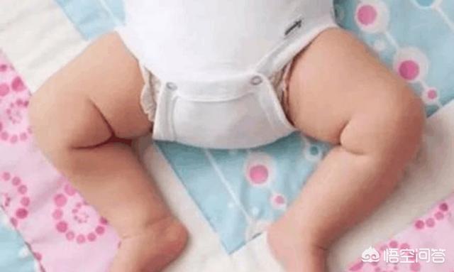 青蛙婴儿:宝宝“青蛙腿”，大人需要纠正吗