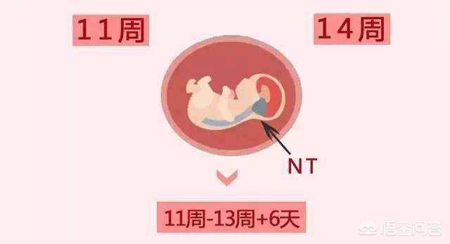 准妈妈多大年龄算高龄产妇，34周岁怀孕算高龄产妇吗二胎需要做NT和糖筛吗