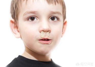 儿童鼻炎怎么办(儿童鼻炎怎么办能看好吗)