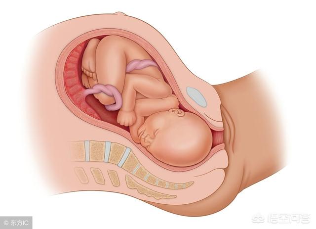 肩难产:肩难产腹围标准 新生儿臂从神经损伤能治好吗？
