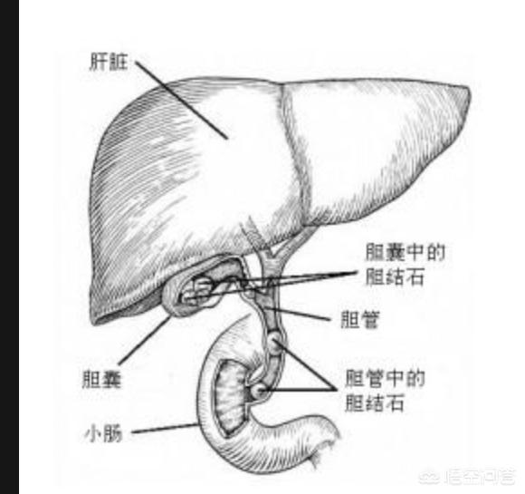 头条问答 胆囊炎会引起右肋骨下疼痛吗,该怎么缓解(14个回答)