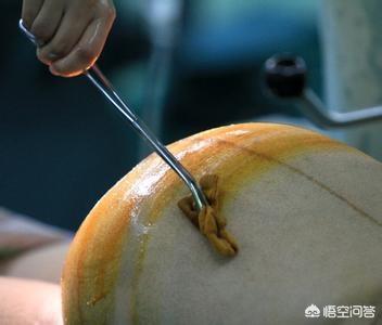 头条问答 - 医生为何有可能误将纱布,设备遗忘在患者体内?(14个回答)