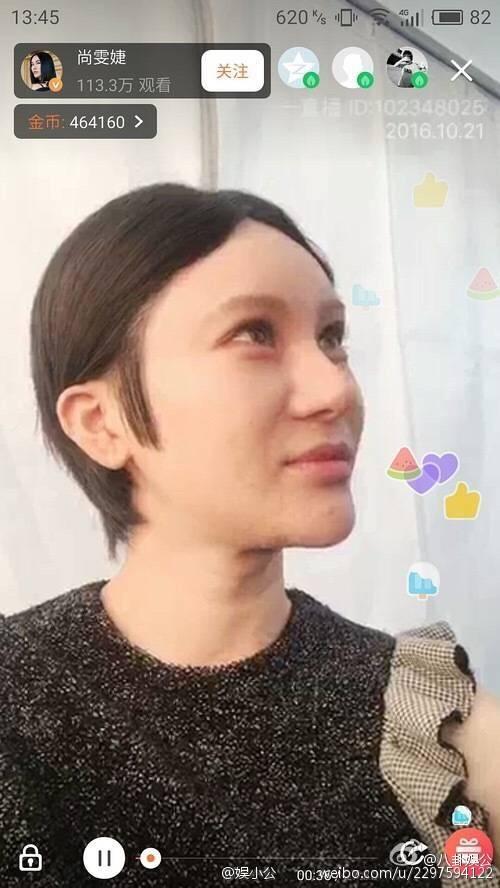 孙菲菲整容失败:女神整容成网红，或者整容失败的女星有哪些