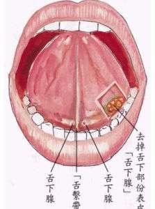 舌下腺囊肿症状疼吗:大家对舌下腺囊肿知道嘛？