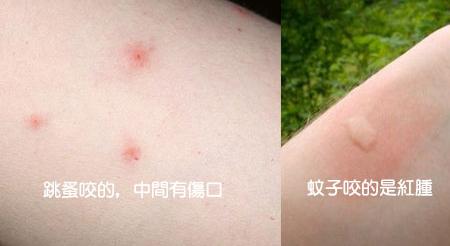 头条问答 - 同事养狗把跳蚤带到科里跑到我身上了,该怎么办?(4个回答)