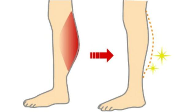哪些方法可以瘦腿呢？插图67