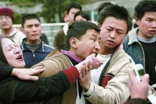 湛江疯狗病视频:被正在发病的疯狗咬伤，不做任何处理，被咬者发病的概率是多少？