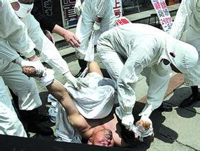 湛江疯狗病视频:被正在发病的疯狗咬伤，不做任何处理，被咬者发病的概率是多少？