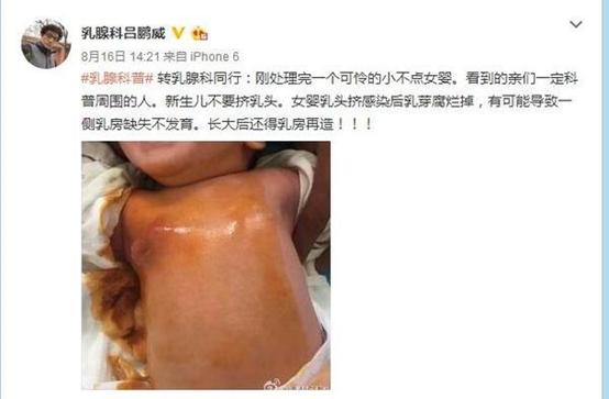 少女挤奶喂狗视频大全:新生儿必须挤乳头的说法科学吗？