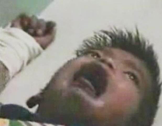 湛江疯狗病视频:被正在发病的疯狗咬伤，不做任何处理，被咬者发病的概率是多少？